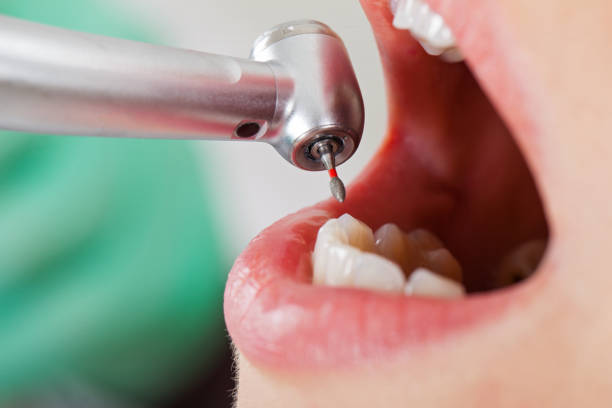 Best Emergency Broken Tooth Repair in Lincoln Park, NJ